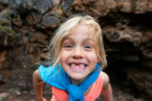 Little girl smiling missing two front teeth