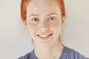 A person with two colored eyes