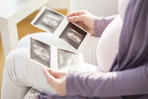 Ultrasound